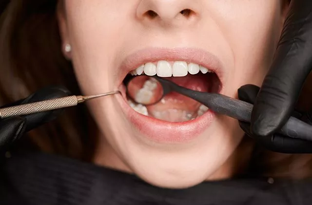 В чем отличие ретинированного зуба?